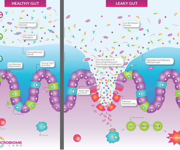 GastrointestinalHealth_LeakyGutGraphic